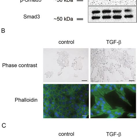 TGF β induces EMT in CMT64 lung adenocarcinoma cells A CMT64 cells