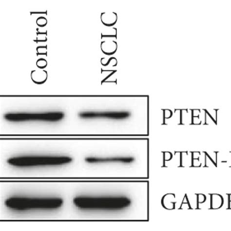 A Decrease In Pten And Pten L Expression Was Observed In Nsclc Tissues