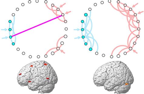 Cntnap Variants Alter Brain Connectivity Spectrum Autism Research News