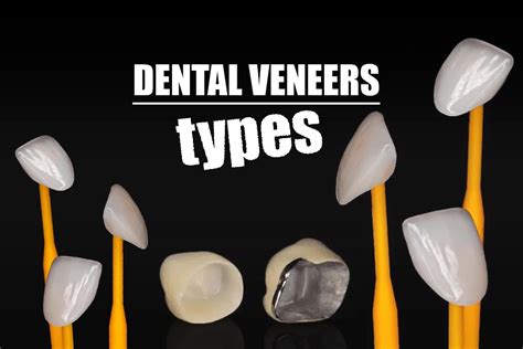 Dental Veneers Types 2024 International Plus Turkey