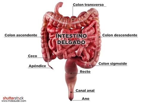 Colitis Ulcerosa Qué Es Síntomas Y Tratamiento Mdsaúde