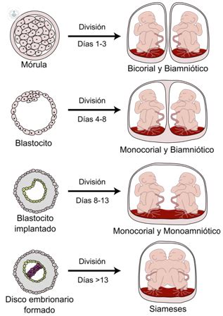 Qu Diferencia Hay Entre Los Gemelos Y Los Mellizos By Enrique