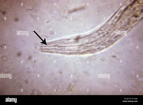 Ancylostoma Hi Res Stock Photography And Images Alamy