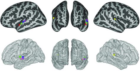 Locations Of The IEEG Electrodes Used For Human Electrophysiology