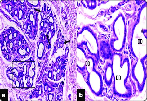 Light Micrograph Of Labial Salivary Gland Of The Excised Tissues A