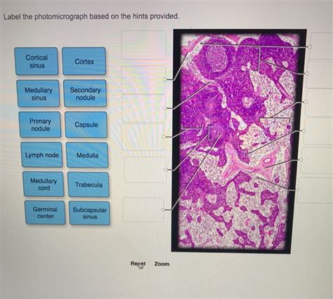 Label The Photomicrograph Based On The Hints Provided