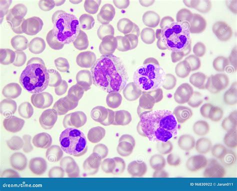 White Blood Cells Stock Photo Image Of Blood Neutrophil 96830922