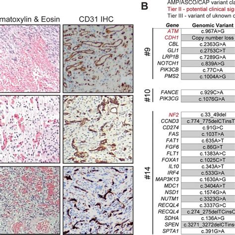 Clinical Presentation And Genomics Of Angiomatous Meningiomas A