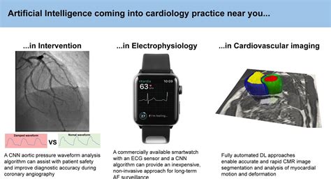 Artificial Intelligence And The Cardiologist What You Need To Know For