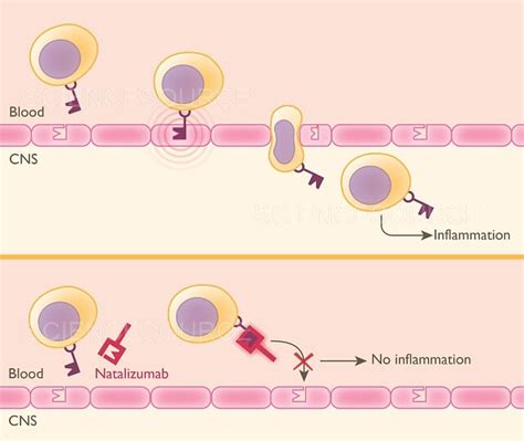 Photograph | Natalizumab Mechanism of Action, Illus | Science Source Images