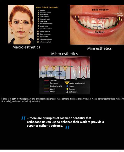 What Is Esthetics In Dentistry at Gemma Nock blog