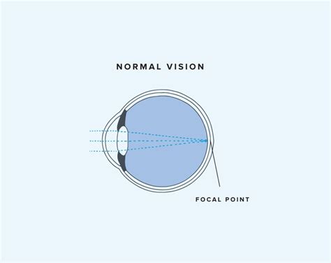 Nearsighted vs. Farsighted: Key Differences | Warby Parker