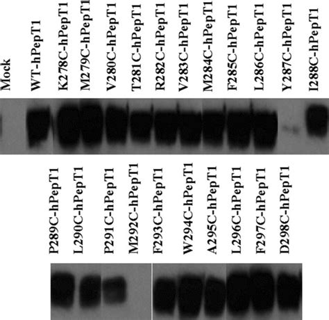 Immunoprecipitation And Western Blot Analysis Of The Mutated HPepT1