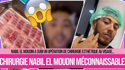 NABIL EL MOUDNI MÉCONNAISSABLE APRÈS UNE OPÉRATION DE CHIRURGIE