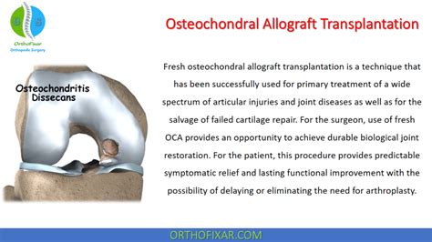 Procedure Category Knee Procedures Orthofixar