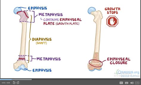 Solution Rickets Osteomalacia And Osteoporosis Studypool