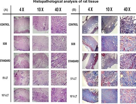 Histology Of Wound Area Stained With A Hematoxylin And Eosin B