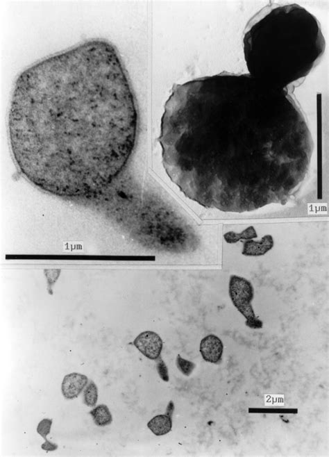 Transmission Electron Micrographs Of Thermococcus Paralvinelleii Strain Download Scientific