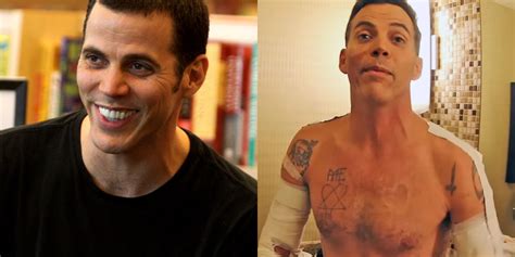 Jackass Forever The 10 Scariest Injuries Of Steve O S Career