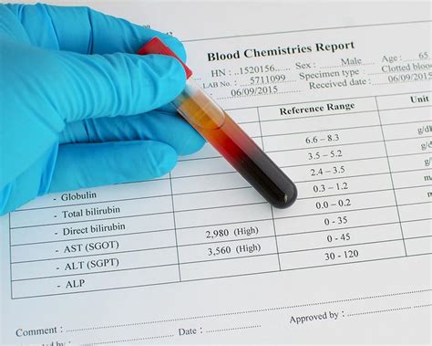 Low AST Levels Of Blood: What Causes It? - Fatty Liver Disease