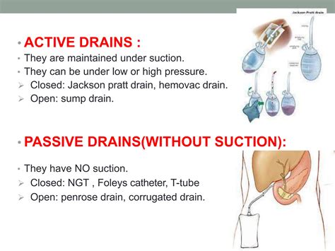 Drains Tubes Used In Surgery Pptx