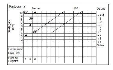 Quest O Analise O Partograma Abaixo Ver Imagem O Parto Representado