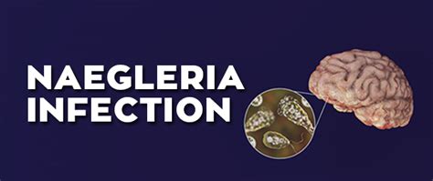 Naegleria Infection - Chughtai Lab