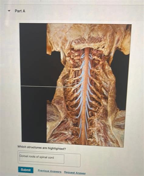 Answered Y Part A Which Structures Are Highlighted Dorsal Roots Of