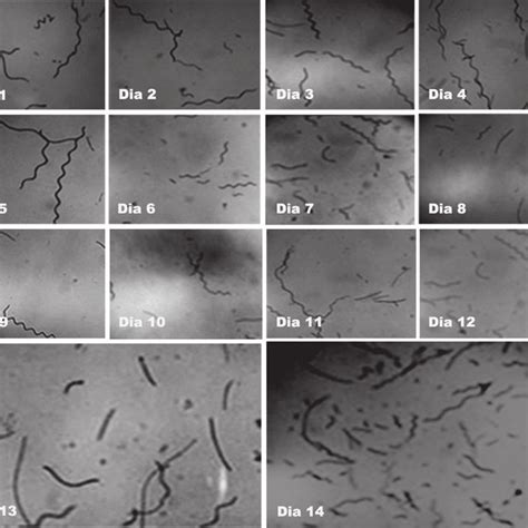 Morfología De Spirulina Platensis Micrografía Electrónica De Los