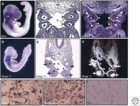 Cardiac Neural Crest