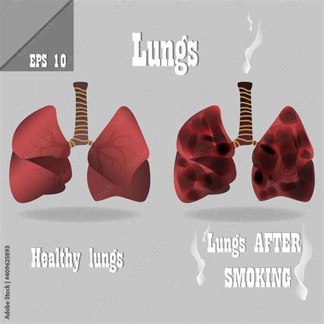 vector medical educational illustration  lungs anatomy healthy lungs