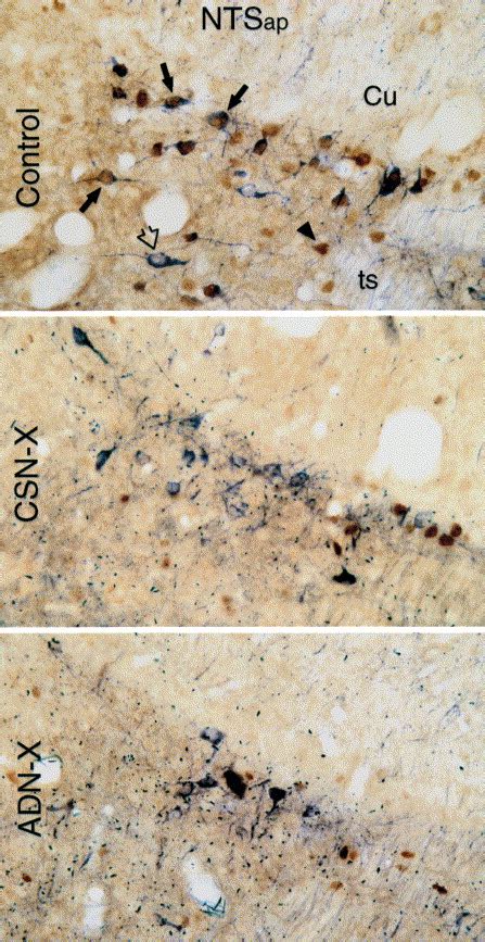 Effects Of Selective Sinoaortic Denervations On Phenylephrine Induced