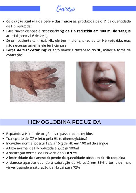 Cianose Em Bebê Tem Cura