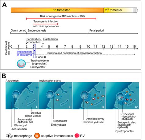 Timeline Of Congenital Defects From Maternal Rubella Virus Rv