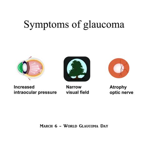 100000 Glaucoma Vector Images Depositphotos