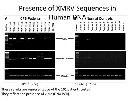 Ppt Xmrv A New Human Pathogenic Retrovirus Detection In Chronic