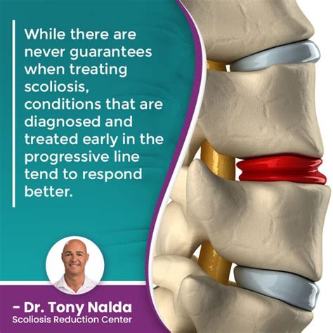 How Serious Is Scoliosis Diagnosis And Treatment Options