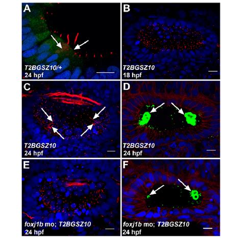 Foxj1b Is Required For The Differentiation Of Motile And Kinocilia