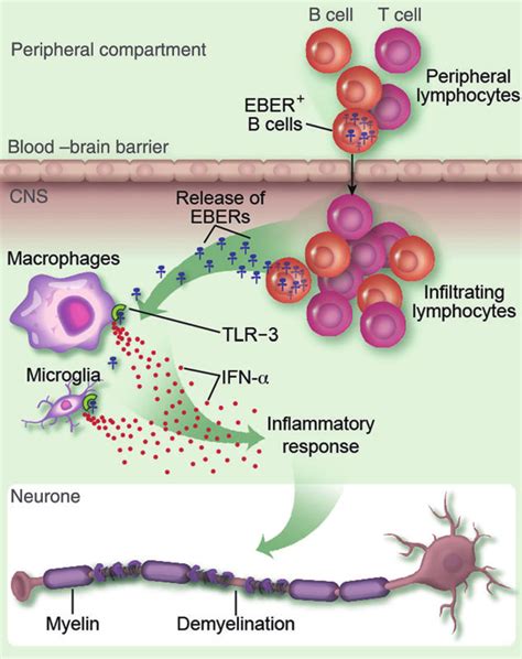 Recruitment Of B Cells Into Active Lesion In Multiple Sclerosis Ms Download Scientific