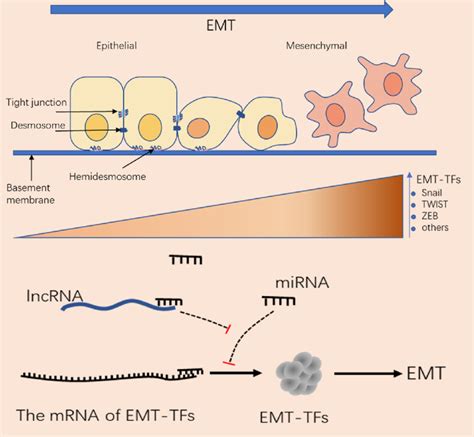 Epithelial Mesenchymal Transformation As Tumor Cells Make The Download Scientific Diagram