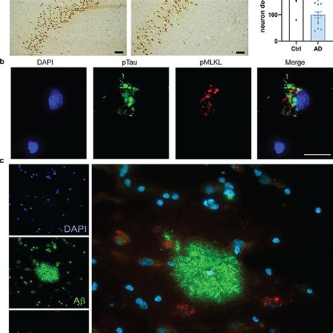 Apoptosis signaling is downregulated in AD hippocampus. a Analysis of ... 