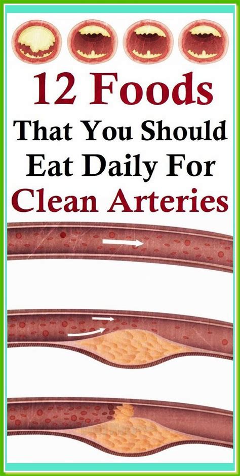 Foods You Should Eat Daily For Clean And Unclogged Arteries