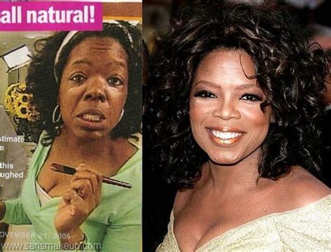 Oprah Winfrey Nose Job Before And After Photo | Black skin, Nose job, Oprah winfrey