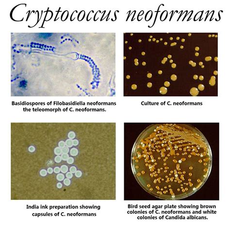 Department Of Microbiology: Cryptococcus neoformans