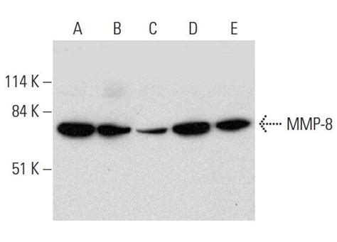 Mmp B Scbt Santa Cruz Biotechnology