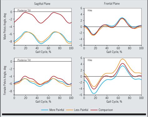 Figure 2 From Gait Alterations In Femoroacetabular Impingement Syndrome