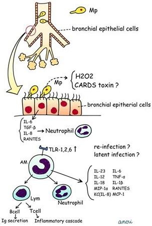 Mycoplasma pneumoniae infection - Symptoms, diagnosis and treatment ...