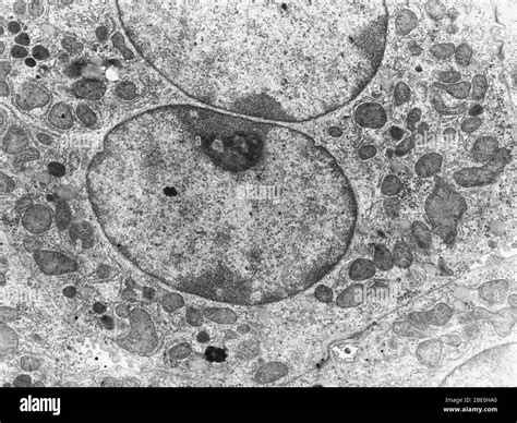 Micrografía de electrones de transmisión TEM de una célula mostrando