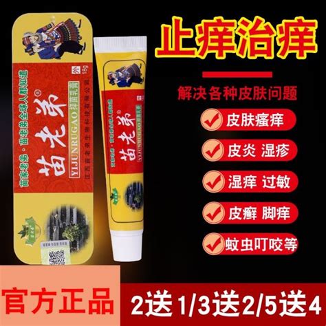 Vivigo Miao Brother Skin Itching Herbal Cream Psoriasis Special Effect