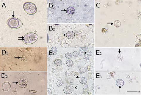 Micrographs Of Protozoan Oocysts Isolated From Stray Cats In Gharbia Download Scientific